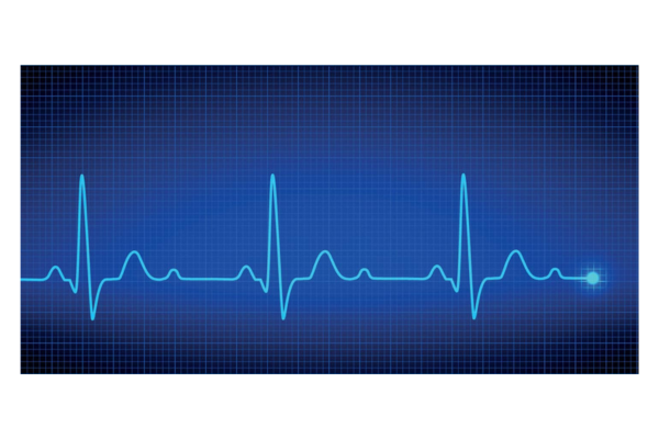 Electrocardiograma